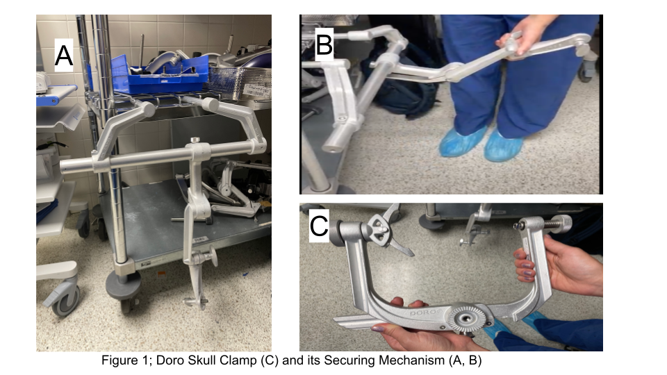 Figure 1; Doro Skull Clamp (C) and its Securing Mechanism (A, B)