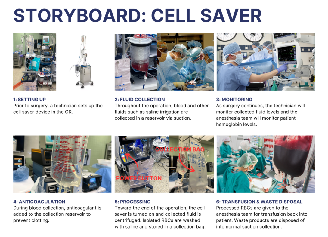 A storyboard of cell saver autologous transfusion during a surgical operation.