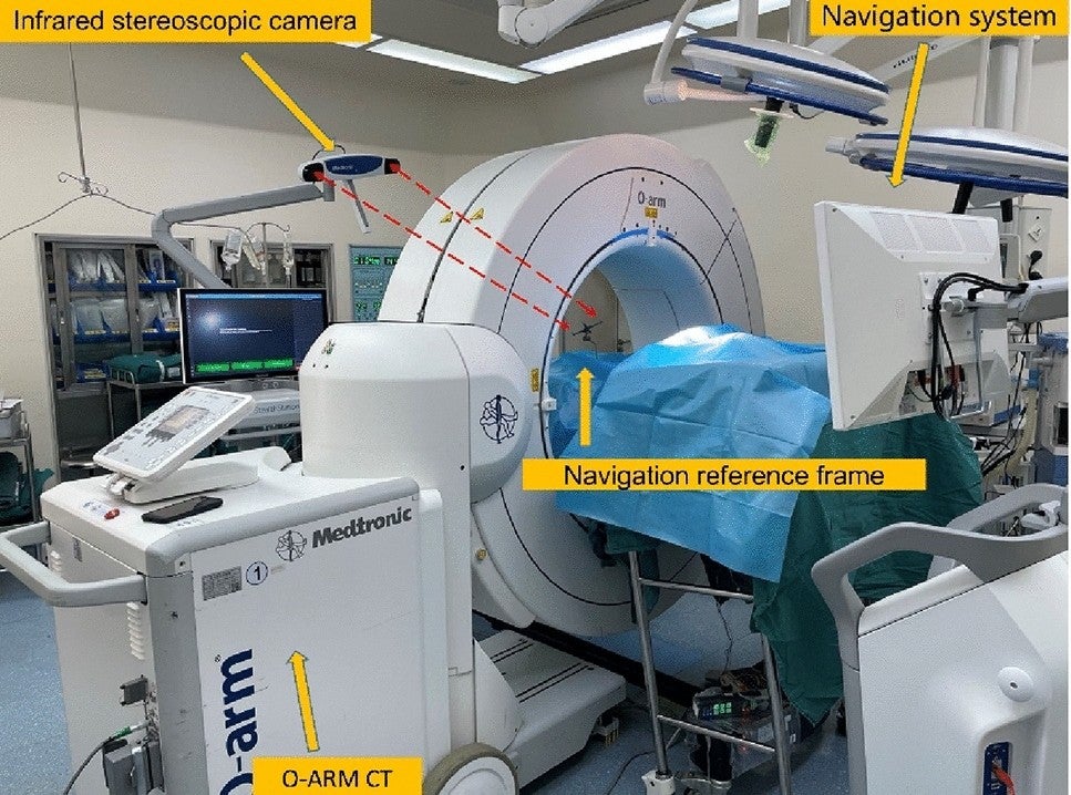 operating room layout