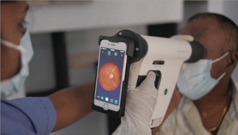 Handheld ophthalmoscope is supported by patient's head and does not require dilation