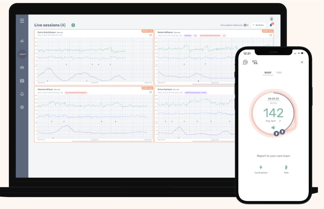 Image of fetal monitoring through INVU