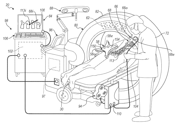 Detailed drawing of surgical optical navigation system